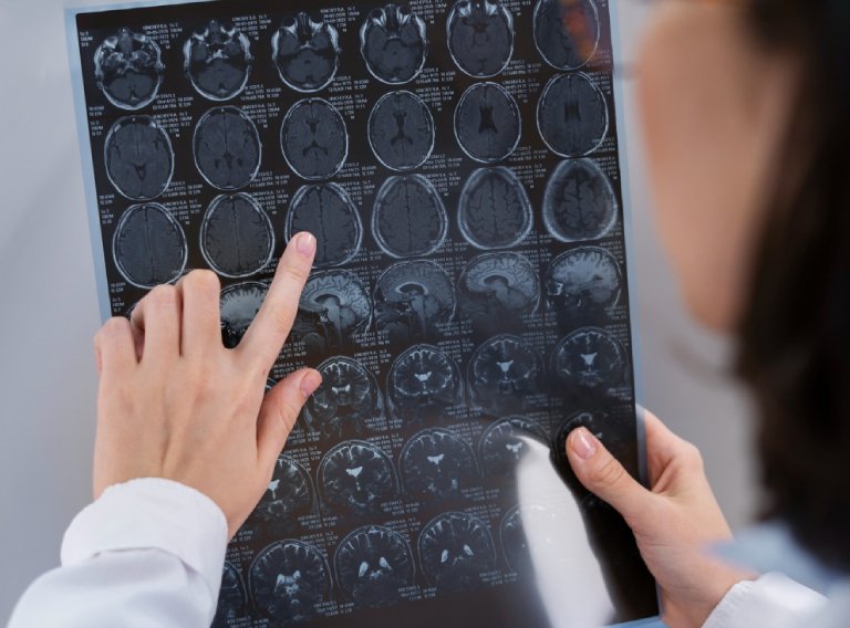 Why Regular MRI Scans Are Essential for Early Disease Detection